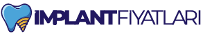 Diş İmplant Fiyatları